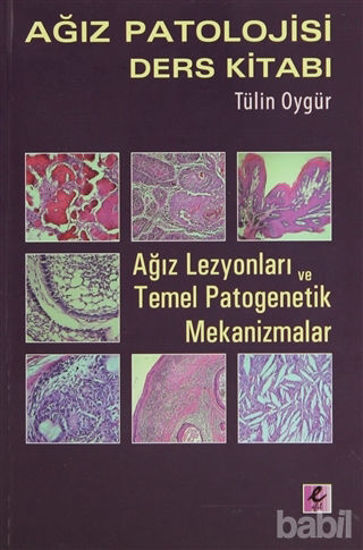 Picture of Ağız Patolojisi Ders Kitabı