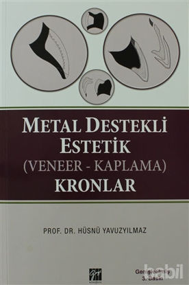 Picture of Metal Destekli Estetik (Veneer-Kaplama)Kronlar