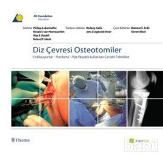 Picture of Diz Çevresi Osteotomiler