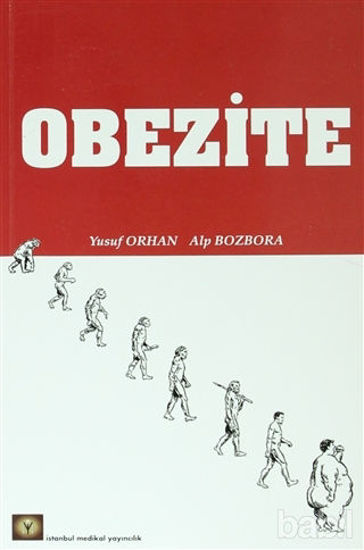 Picture of Obezite