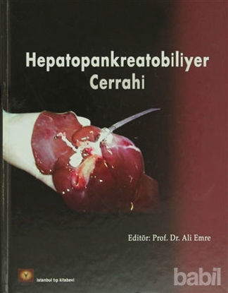 Picture of Hepatopankreatobiliyer Cerrahi