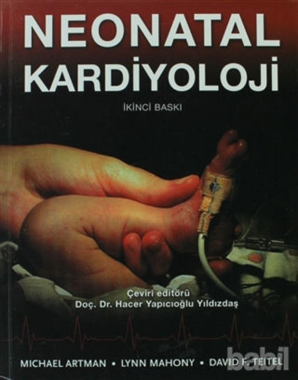 Picture of Neonatal Kardiyoloji