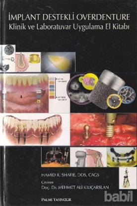 Picture of İmplant Destekli Overdenture
