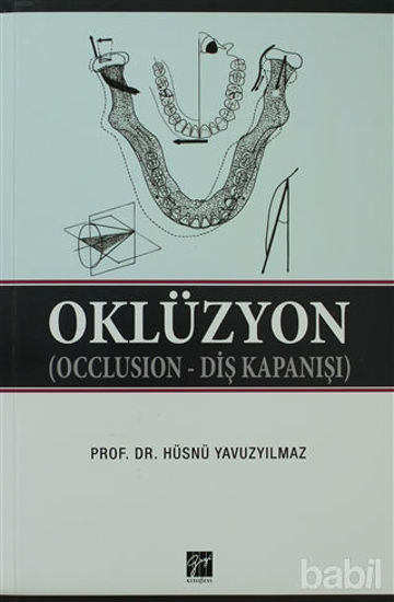 Picture of Oklüzyon