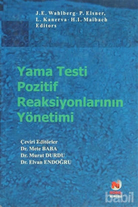 Picture of Yama Testi Pozitif Reaksiyonlarının Yönetimi