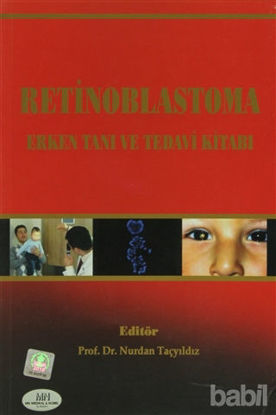 Picture of Retinoblastoma Erken Tanı ve Tedavi Kitabı