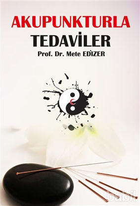 Picture of Akupunkturla Tedaviler