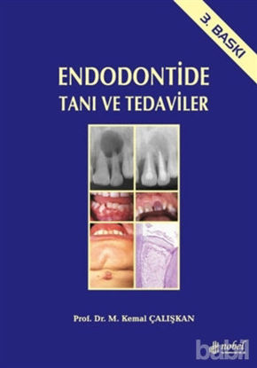 Picture of Endodontide Tanı ve Tedaviler