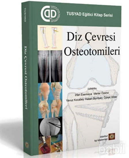 Picture of Diz Çevresi Osteotomileri