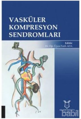 Picture of Vasküler Kompresyon Sendromları