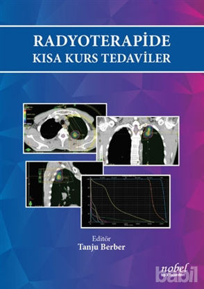 Picture of Radyoterapide Kısa Kurs Tedaviler