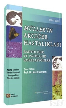Picture of Müller’in Akciğer Hastalıkları
