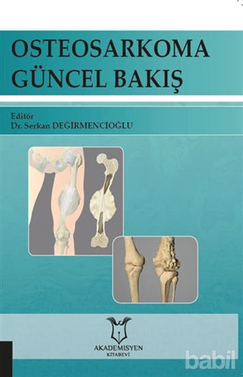 Picture of Osteosarkoma Güncel Bakış