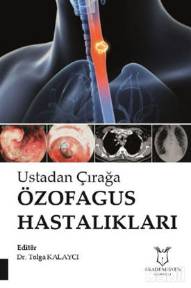 Picture of Ustadan Çırağa Özofagus Hastalıkları