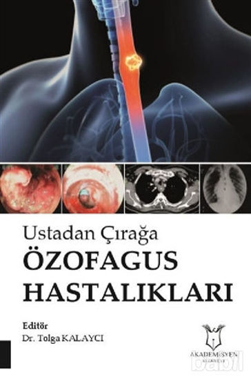 Picture of Ustadan Çırağa Özofagus Hastalıkları
