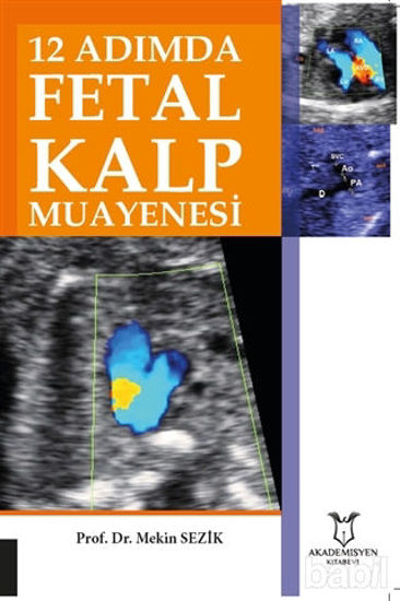 Picture of 12 Adımda Fetal Kalp Muayenesi