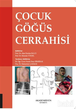 Picture of Çocuk Göğüs Cerrahisi