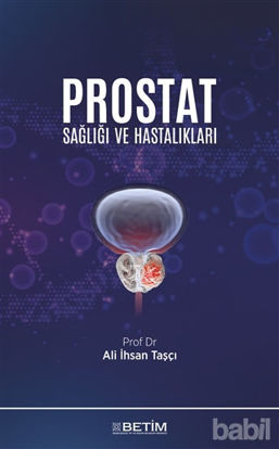 Picture of Prostat Sağlığı ve Hastalıkları