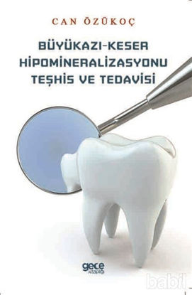 Picture of Büyükazı-Keser Hipomineralizasyonu Teşhis ve Tedavisi